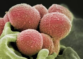 ক’ৰ পৰা আহিল ৪৮ ঘণ্টাত প্ৰাণ লোৱা বেক্টেৰিয়া?