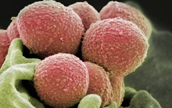 ক’ৰ পৰা আহিল ৪৮ ঘণ্টাত প্ৰাণ লোৱা বেক্টেৰিয়া?