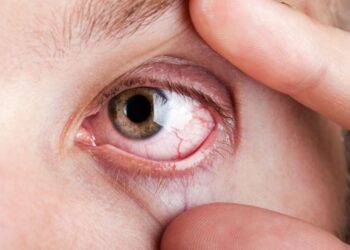 আজৱ! একেটা পৰিয়ালৰে চাৰিজনে দেখা নাপায় দিনত আৰু দুজনে দেখা নাপায় নিশা