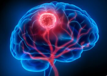 ১ ঘণ্টাৰ এই তেজ পৰীক্ষাই চিনাক্ত কৰিব পাৰে মস্তিষ্কৰ কৰ্কট ৰোগ, জানক সবিশেষ