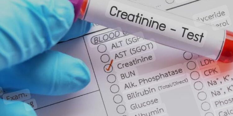 শৰীৰত ক্ৰিয়েটিনিন বৃদ্ধি পালে কি হ’ব পাৰে ?