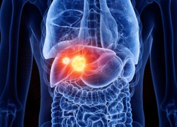 সাৱধান! ডায়েবেটিছ আৰু উচ্চ কলেষ্টেৰলত ভোগা ৰোগীৰ হ’ব পাৰে লিভাৰ কেন্সাৰ…