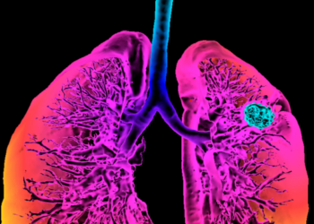 আচৰিত! এবছৰীয়া শিশুৰ হাওঁফাওঁৰ পৰা ওলাল গোমধানৰ বীজ