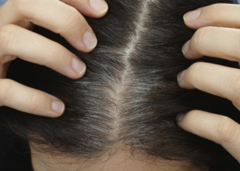 ৩০ বছৰ বয়সতে ধূসৰ হৈ পৰিছে নেকি আপোনাৰ চুলি? জানক এই সন্দৰ্ভত বিশেষজ্ঞই কি কয়…