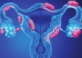 Uterus Infection কি? জানক ইয়াৰ লক্ষণসমূহ