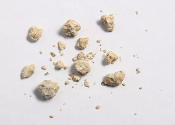 বৃক্কত পাথৰ হোৱাৰ ডাঙৰ কাৰণ, আপুনিও একে ভুল কৰিছে নেকি?