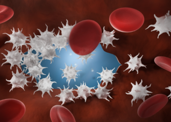 শৰীৰত প্লেটলেট কমিলে দেখা দিয়ে এই সমূহ লক্ষণ, জানো আহক বিশেষজ্ঞই কি কয়…