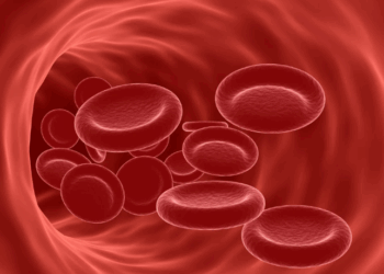 পুৰুষতকৈ আইৰণৰ অভাৱৰ প্ৰৱণতা বেছি মহিলাৰ দেহত! এই লক্ষণবোৰক কেতিয়াও আওকাণ নকৰিব…