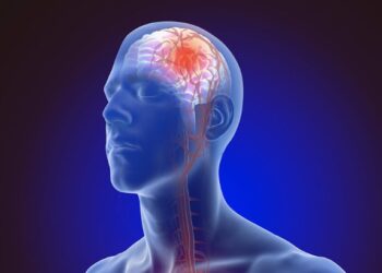 মগজুৰ ষ্ট্ৰোক হোৱাৰ পূৰ্বে শৰীৰে দিয়ে এই ৫ সংকেত, জানক সবিশেষ…