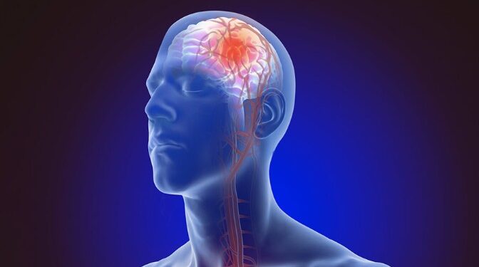 মগজুৰ ষ্ট্ৰোক হোৱাৰ পূৰ্বে শৰীৰে দিয়ে এই ৫ সংকেত, জানক সবিশেষ…